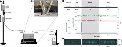 Effects of Hydrostatic Pressure on Electrical Retinal Activity in a Multielectrode Array-Based ex vivo Glaucoma Acute Model